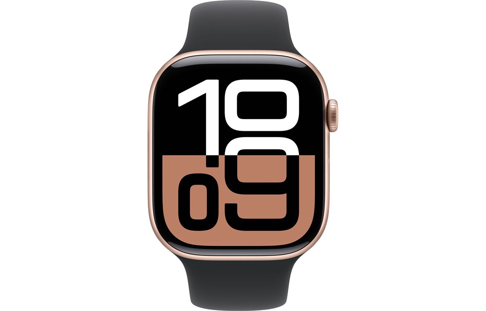 Apple Watch Series 10, 42 мм, Gold, Алюминиевый корпус с Black Sport Band - S/M (130-180мм) — изображение 2